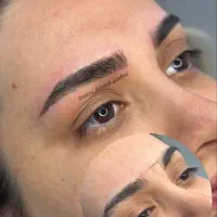 میکروبلیدینگ