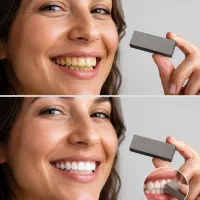 پولیشر دندانهای کامپوزیت
