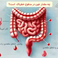 بهبود بواسیر،همورئید