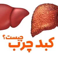 کبدت رو اصولی درمان کن