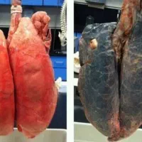 ترک سیگار در ۲ روز