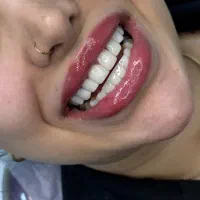 خدمات کامپوزیت