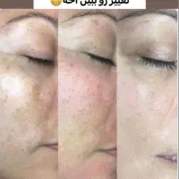 کرم ضدلک لاکچری کوین(کرم ۸ کاره)|آرایشی، بهداشتی، درمانی|شیراز, ملاصدرا|دیوار