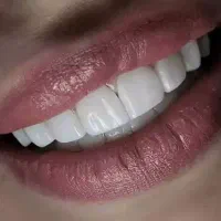 دندانسازی همتی