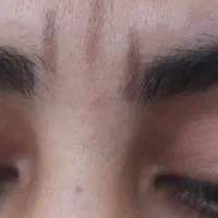 اصلاح تخصصی ابرو وصورت