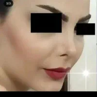 جشنواره لیپو .مامو .بینی بلفارو کل صورت .چک صیادی|خدمات آرایشگری و زیبایی|تهران, دروس|دیوار