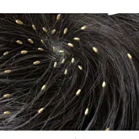 داروی صدرصد گیاهی رشکو و شپش