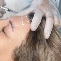 جشنواره باور نکردنی ویژه. ژل و بوتاکس.فیلر مزو ژل|خدمات آرایشگری و زیبایی|شیراز, سینما سعدی|دیوار