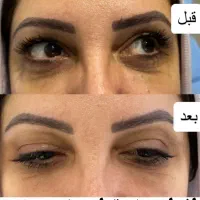 ژل وبوتاکس نخ فیلربادی توسط پزشک|خدمات آرایشگری و زیبایی|تهران, جمهوری|دیوار