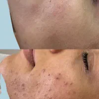فیشیال VIP تخصصی/تخفیف ویژه