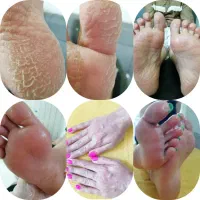 پدیکور درمانی مانیکور پارافین دست وپا|خدمات آرایشگری و زیبایی|کارون, |دیوار