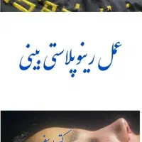 جشنواره ویژه جراحی بینی رینوپلاستی قیمت استثنایی