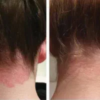 درمان مشکلات پوستی|آرایشی، بهداشتی، درمانی|جوانرود, |دیوار