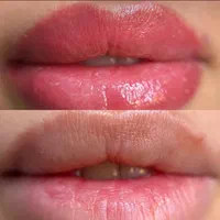 مرکز تخصصی فیبروز شیدینگ لب و بن مژه|خدمات آرایشگری و زیبایی|مشهد, احمدآباد|دیوار