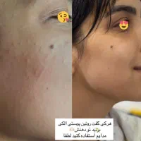 جشنواره پاکسازی رایگان بانوان با متریال اروپایی