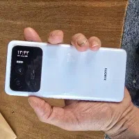 mi11اولترا