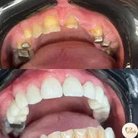 دندان پزشکی|خدمات آرایشگری و زیبایی|قم, نوقطار|دیوار