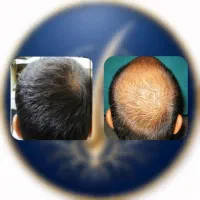 18 روزه|آرایشی، بهداشتی، درمانی|کرمانشاه, |دیوار