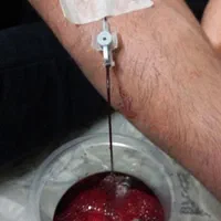 حجامت/رگگیری سیاتیک/زالودرمانی|خدمات آرایشگری و زیبایی|شیراز, عادل آباد|دیوار