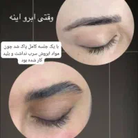 ابرسانی عمیق پوست به صورت تزریقی فقط ۱۴۰۰|خدمات آرایشگری و زیبایی|یاسوج, |دیوار