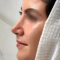 انجام عمل جراحی توسط فوق تخصص جراحی پلاستیک|خدمات آرایشگری و زیبایی|تهران, بلوار کشاورز|دیوار