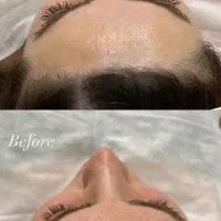 فیشال پوست لیفت مژه کراتین لیفت ابرو میکروبلیدینگ|خدمات آرایشگری و زیبایی|نیشابور, دارایی|دیوار