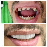 دندانپزشکی و دندانسازی