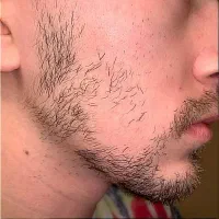 ریش میخوای  پس شروع کن