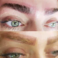 ریموو پاک کردن تتوهای بدرنگ وقدیمی