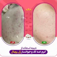 کرم ژل رویال صد در صد تضمینی|آرایشی، بهداشتی، درمانی|شیراز, حافظیه|دیوار
