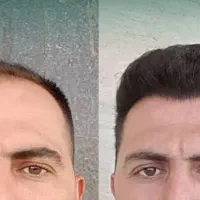 کاشتمو پنجاه درصد اف