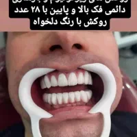 زیبایی دندان و ترمیم و درمان تخصصی|خدمات آرایشگری و زیبایی|ملارد, |دیوار