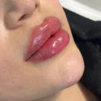 فیلر لب بوتاکس مادلینگ زیرچشم فیلر باسن بیکینی نخ|خدمات آرایشگری و زیبایی|تهران, پاسداران|دیوار