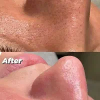 پاکسازی پوست با تخفیف ویژه|خدمات آرایشگری و زیبایی|رشت, استقامت ۱|دیوار