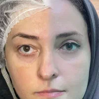 دستیار و اد جراحی زیبایی ، کارشناس اتاق عمل|خدمات آرایشگری و زیبایی|تهران, مرزداران|دیوار