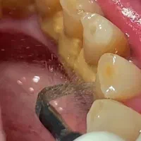 اطفال و نوجوان دندانپزشککی|خدمات آرایشگری و زیبایی|قم, زنبیل آباد|دیوار