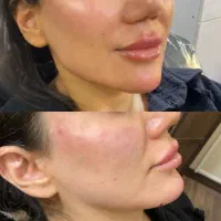 تخفیف باورنکردنی ژل، بوتاکس، آموزش|خدمات آرایشگری و زیبایی|شیراز, معالی‌آباد|دیوار