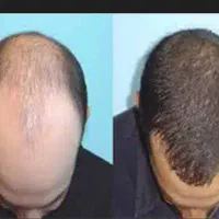 رزماری گیاهی برای کسانی که مو میریزه|گل و گیاه طبیعی|خرمشهر, |دیوار