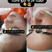 مدل فشیال Vip پوست
