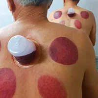 مرکز حجامت شهرری