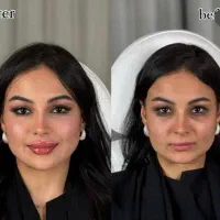 فیلرلب مادلینگ جوانسازی بوتاکس فیلرزیرچشم فیلربادی|خدمات آرایشگری و زیبایی|تهران, سید خندان (جلفا)|دیوار
