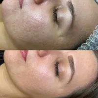 لیزر موهای زائد۲۰۲۵، بوتاکس،فیلر توسط پزشک|خدمات آرایشگری و زیبایی|تهران, جوادیه|دیوار