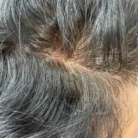 اسکراب و پاکسازی تخصصی کف سر /درخشش و رشد مو|خدمات آرایشگری و زیبایی|صدرا-فارس, فاز ۱|دیوار