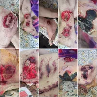 کلینیک زخم نور|خدمات آرایشگری و زیبایی|خرم‌آباد, |دیوار