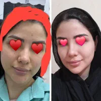 کرم وی آی پی اماراتی گیاهی 350|حراج|بم, |دیوار