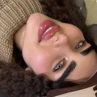 ژل بوتاکس‌مزوسفید کننده صورت۲میلیون بوتاکس۱۳۰۰فیلر