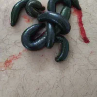 حجامت. فصد. زالو درمانی.|خدمات آرایشگری و زیبایی|مشهد, شاهد (شهرک غرب)|دیوار