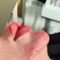 تزریق ژل وبوتاکس آموزش ژل وبوتاکس آنزیم فیلربادی|خدمات آرایشگری و زیبایی|کرمانشاه, |دیوار