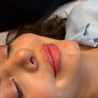 خدمات و اموزش تخصصی ژل و بوتاکس تضمینی (عملی)