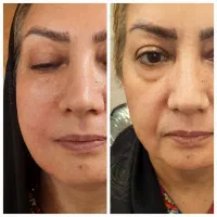 ویزیت پزشک عمومی و خدمات زیبایی